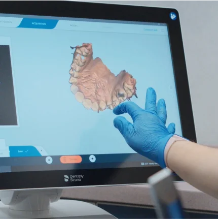 Dental x-ray at San Diego dental clinic for accurate diagnosis and effective oral care.