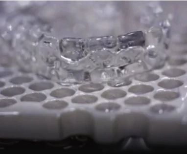 Second step of Invisalign: Custom aligners and treatment plan.